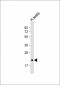 CD81 Antibody